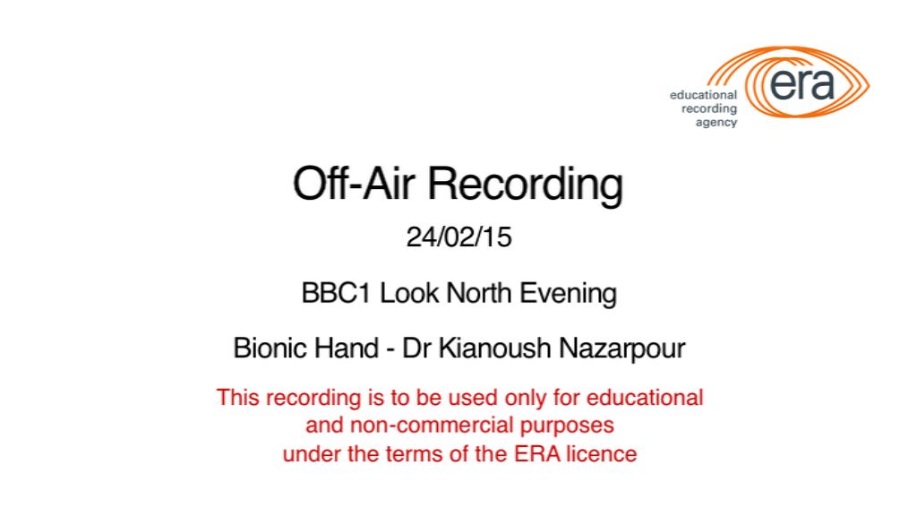 Bionic Hand BBC Look North Evening