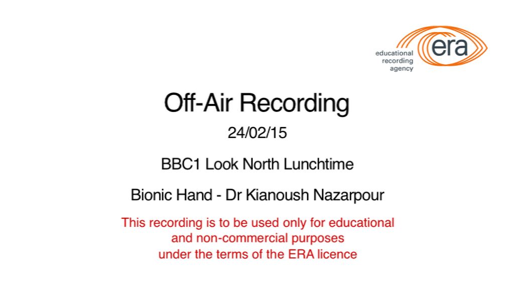 Bionic Hand - BBC Look North Lunchtime