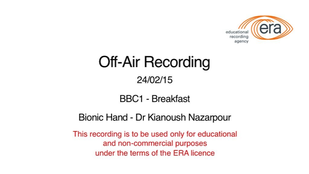Bionic Hand - BBC Breakfast